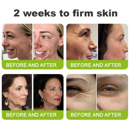🧠👨‍⚕️Made and shipped from the USA 💫LOVILDS® Skin Tightening & Vita-A Retinol Retinol shot Anti-Wrinkle Firming Tightening cream