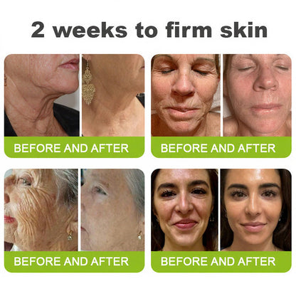 🧠👨‍⚕️Made and shipped from the USA 💫LOVILDS® Skin Tightening & Vita-A Retinol Retinol shot Anti-Wrinkle Firming Tightening cream