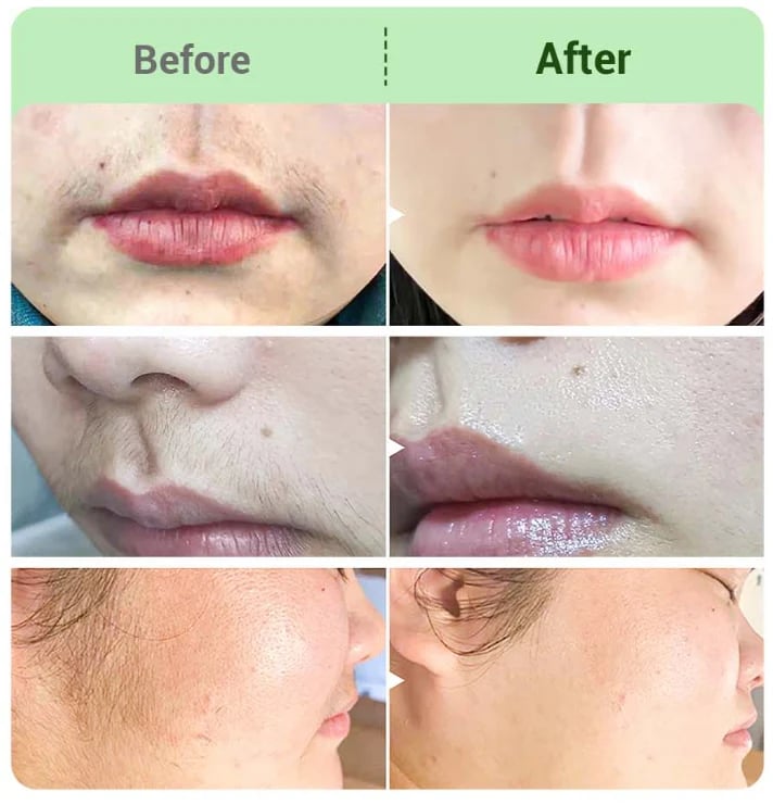 🌿 Painless Hair Removal Cream for Hormonal Facial Hair | Dermatologist-Recommended | Smooth, Flawless Skin Without Irritation ✨ | Quick & Long-Lasting Results 💖