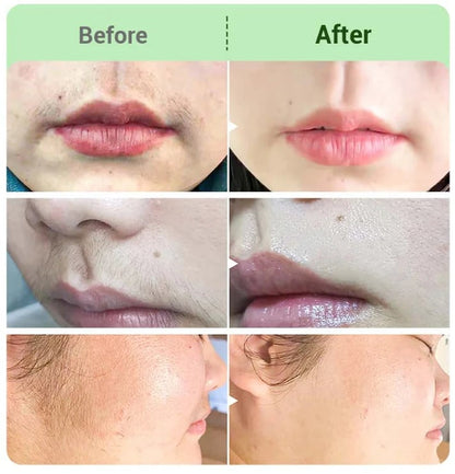 🌿 Painless Hair Removal Cream for Hormonal Facial Hair | Dermatologist-Recommended | Smooth, Flawless Skin Without Irritation ✨ | Quick & Long-Lasting Results 💖