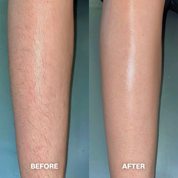 TAILEDEN™ Hair Removal Cream for All Women & Men